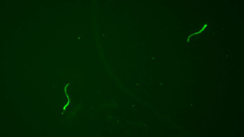 綠色熒光蛋白（GFP）在C elegans上的表達